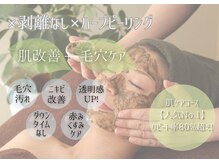 ラポーチェ(LAPOCHE)の雰囲気(【話題ニキビ毛穴ケア】違いがわかる!自慢のハーブピーリング☆)
