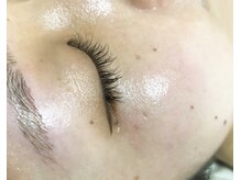 サロン ミワ(salon MIWA)/お顔ワックス脱毛