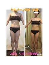 リオンズ 茨城ミスターマックス取手店/セルバーン付き　24回　20代女性