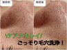 【平日限定】頑固な角栓ごっそり大掃除！＋選べるメニュー￥4980
