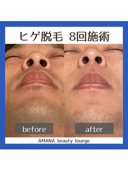 アマナ(AMANA)/処理の回数激減!朝が楽に☆