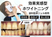 ベティー(Betee)