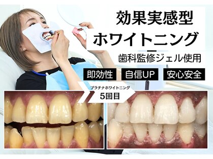 ベティー(Betee)の写真