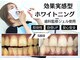 ベティー(Betee)の写真