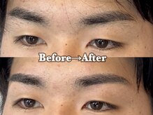 メンズ脱毛 メンズエステ エイト(8)/20代 眉毛wax脱毛のお客様