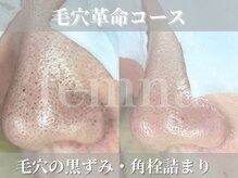 フェミナ(femna)/メンズにもオススメ！