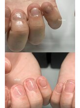ネイルマン 横浜店(Nail Man)/自爪の育成/ビフォー＆アフター