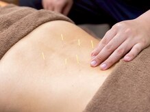 あうる鍼灸接骨院 整体院/【鍼灸】肩こり/腰痛/疲労/歪み