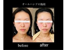 マシュマロヘッド 目黒店(Mashumaro Head)/小顔効果抜群◎本格顔筋ほぐし☆