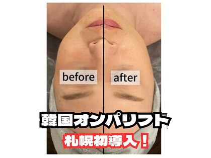 ディア(Deer)の写真