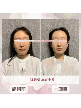 エレーニ 麻布十番(ELENI)/頭蓋骨小顔コルギ/港区/麻布十番