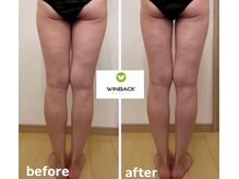 シエルエトワール 唐津店(Ciel Etoile)/WINBACK90分　美脚コース　1回