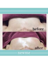 ニュウミー 諏訪本店(newme)/最新機器NRでふっくら美バスト