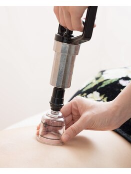 サロン ド アール(salon de R.)/【カッピング・吸玉・施術風景】