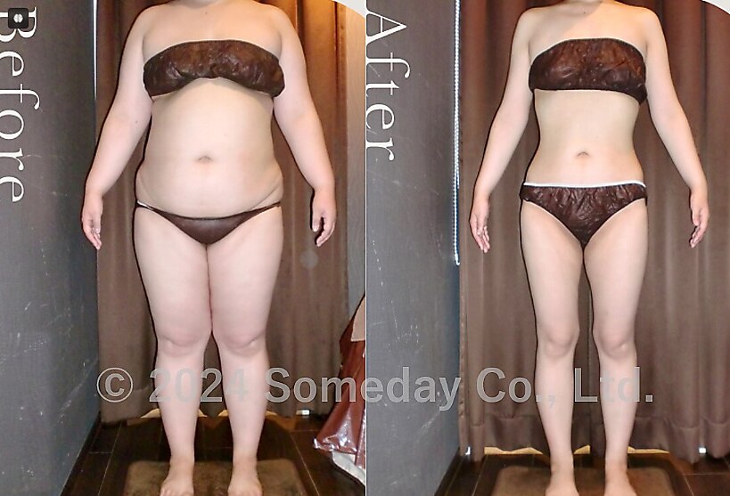 フォト｜サムデイプレミアム 恵比寿店(SOMEDAY PREMIUM