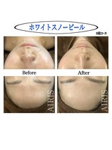 アイリス(AIRIS)/ホワイトスノーピール