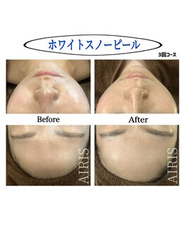 アイリス(AIRIS)/ホワイトスノーピール