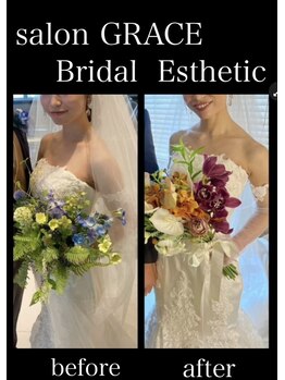 サロン グレイス(salon GRACE)/