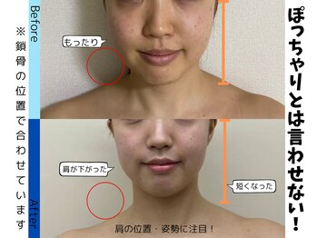 お顔の研究所/ビフォーアフター写真♪