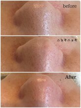 マヴィ 守口店(MavY.)/毛穴ケアお任せ