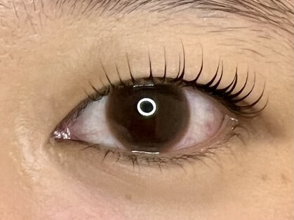 レスト(Rest)の写真