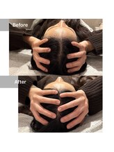 ルネアススパ 南青山(Lune’as Spa)/ドライヘッドスパ