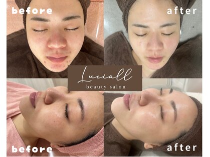 ルシアル(LUCIALL)の写真