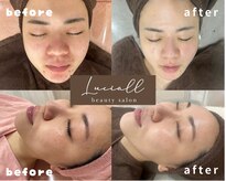 ルシアル(LUCIALL)