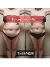 ラブリエ(Labriller)/トリプルアタック痩身