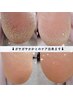【foot】固くなった足裏の角質をつるんとケア＋ワンカラー　¥9900