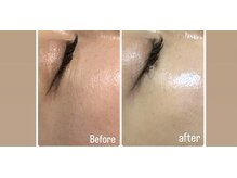 ラグ(LUXU)/ラミネーションピール