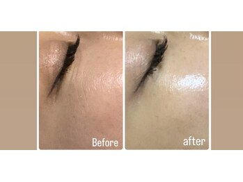 ラグ(LUXU)/ラミネーションピール