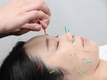フロー鍼灸整体院(FLOW鍼灸整体院)/美容鍼灸