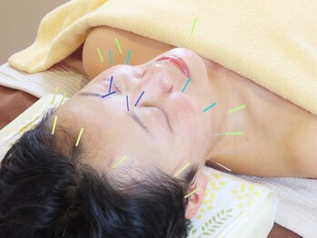 晴レヤカ鍼灸治療院/定期的に受けて更に効果を実感