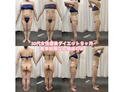パラディ(PARADIS)の写真