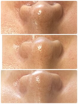 ビーカーブス 三鷹(B.curves)/before・after