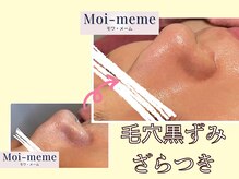 モワメーム(Moi-meme)/