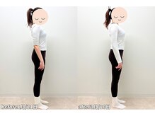 モア 札幌平岸店(MORE)/ヒップアップと横ももの張り取り