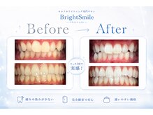 ブライトスマイル 静岡店(Bright Smile)の雰囲気（ご新規様限定価格で初回通常6,500円→1,980円でお試しできます！）