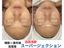 トータルビューティーサロンリア(Li'a)