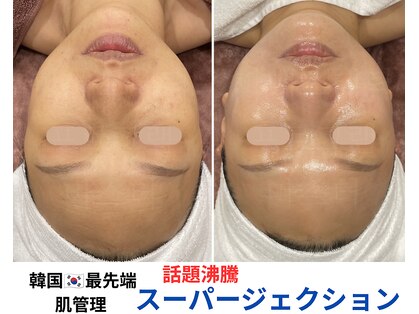 トータルビューティーサロンリア(Li'a)の写真