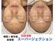 トータルビューティーサロンリア(Li'a)の写真