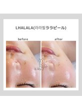 ポムハヌル(pom.haneul)/韓国肌管理室