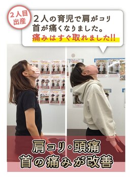 リフラ 南流山店(REFLA)/出産2回 首の痛み・肩こり