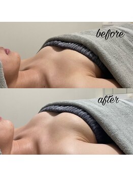 エルエーズ(Elleaise)/バストケアで理想の身体に◎