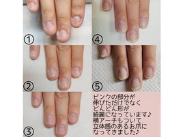 伸びるだけでなく形も変わります