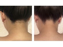 アドビューティ(Add Beauty)/花嫁様プラン／ブライダルエステ