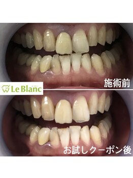 ルブラン 奈良店(Le Blanc)/なんか印象変わったな!?と