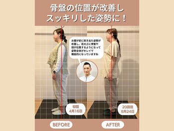 スペックフィジカルコンディショニング(SPECフィジカルコンディショニング)/20代女性/姿勢ビフォーアフター