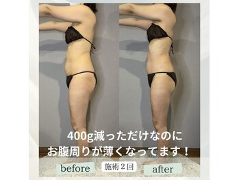 エネイブル(ENable)/